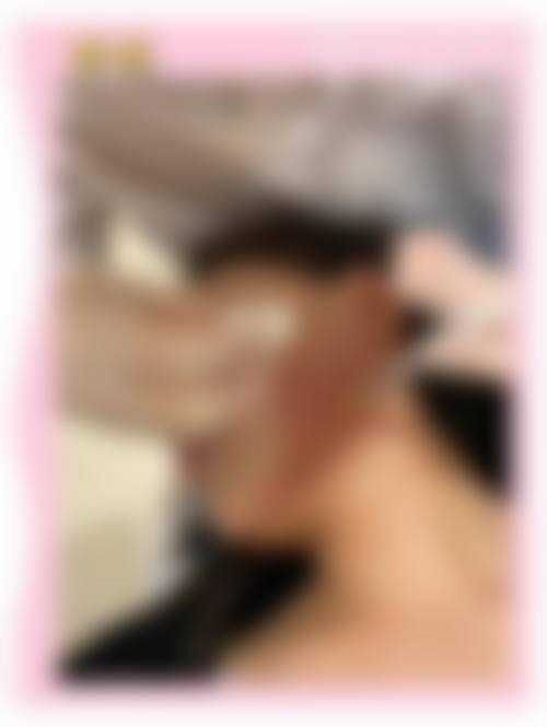 哪些人群在评估中更可能被建议考虑瘦脸针？