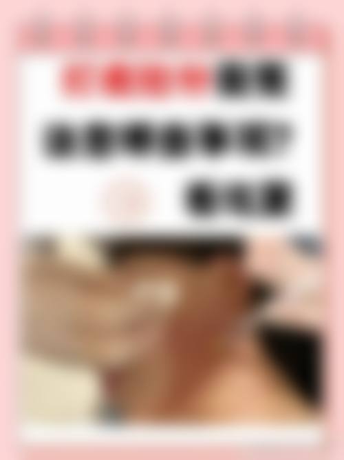 瘦脸针反弹的常见认知偏差与误解