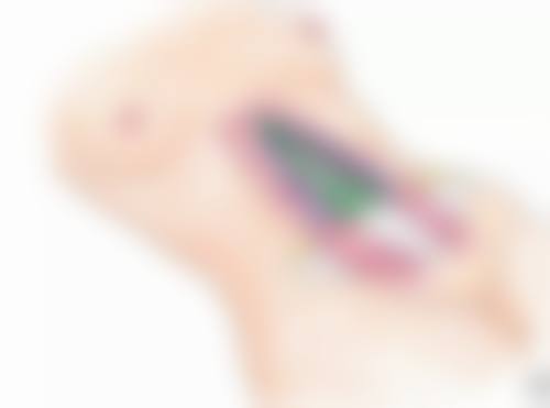 五、在实际操作中，阴道前后壁修复手术更适合哪些人？