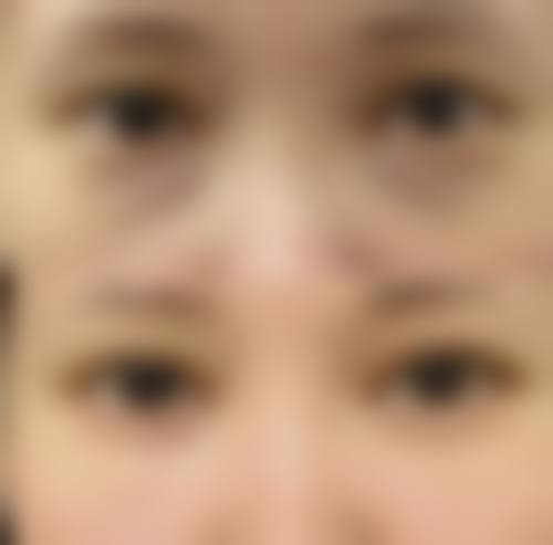 攀枝花市中医和西医结合医院整形美容科是正规医院吗？