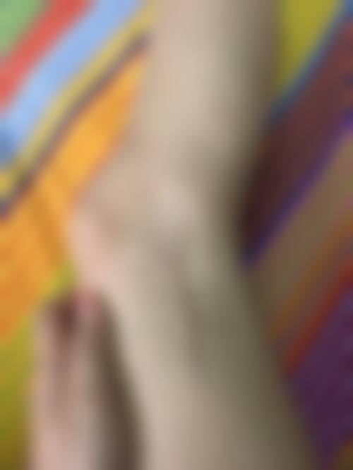 {疤痕做离子束会恢复正常吗？当然能！离子束刺激胶原蛋白再生，多数疤痕可显著改善！看治疗前后对比，效果超惊艳 