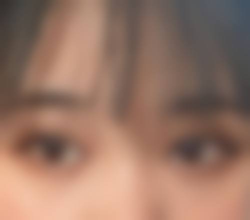 {埋线双眼皮值得吗？2000元低价享恢复快效果自然体验，优势多当然值得尝试！ 