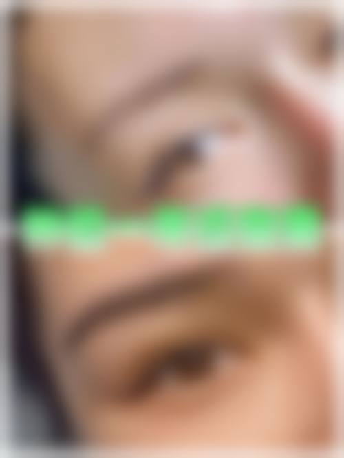 八、疤痕体质纹眉的成效稳定性取决于哪些因素？