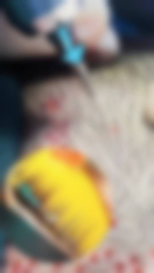 七、疤痕体质纹眉的费用为何差异明显？价格区间如何形成？