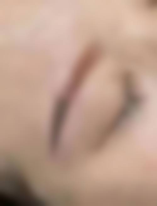 三、从医学角度看，疤痕体质纹眉的核心目的是什么？