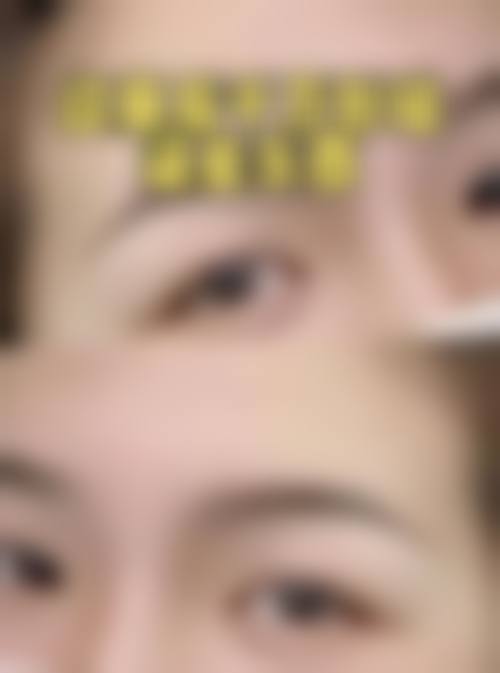 五、在实际操作中，疤痕体质纹眉更适合哪些人？