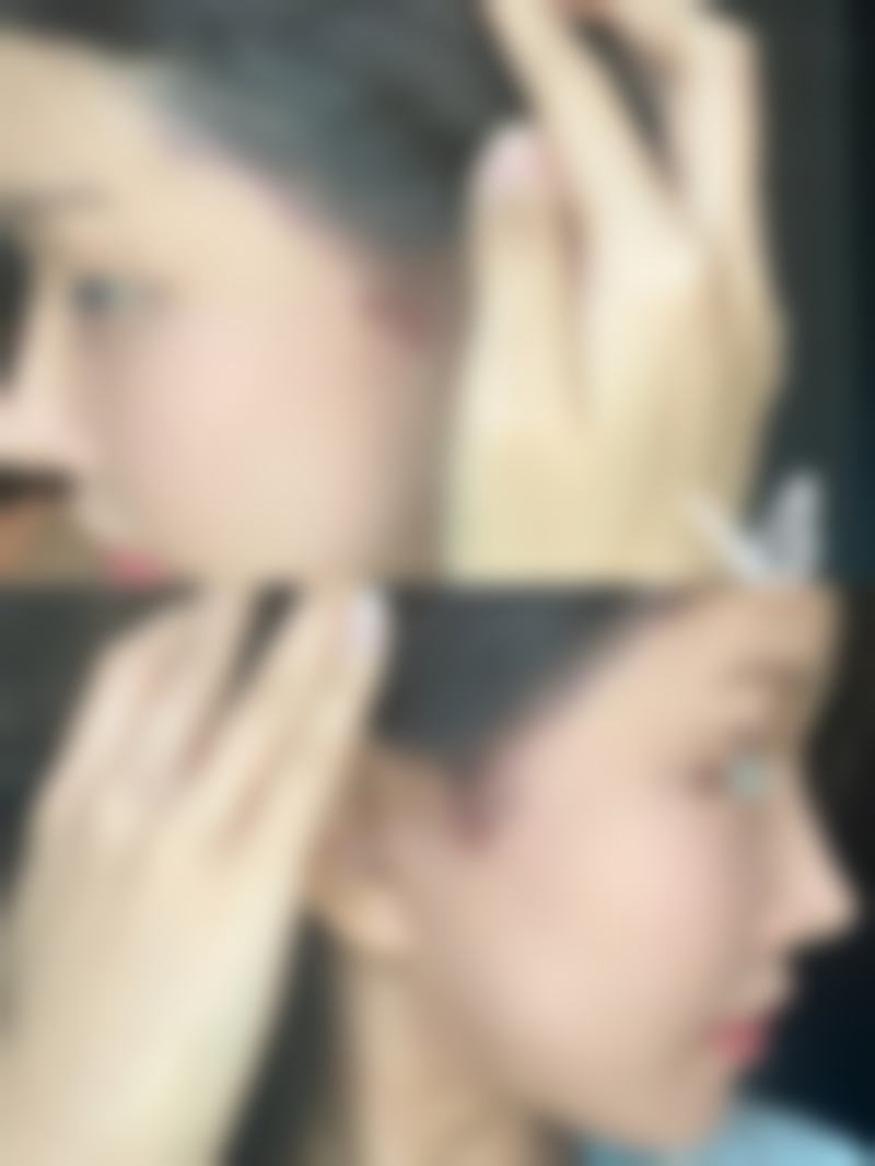 八、阴道前后壁修复手术的成效稳定性取决于哪些因素？