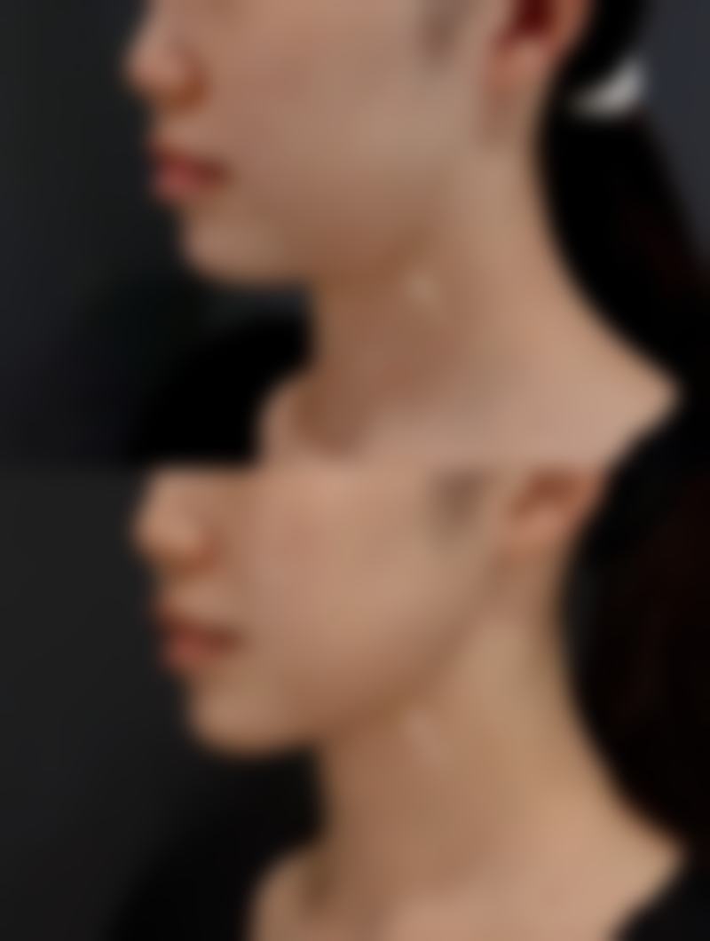 十、选择阴道前后壁修复手术相关医院与医生时，应重点看哪些维度？