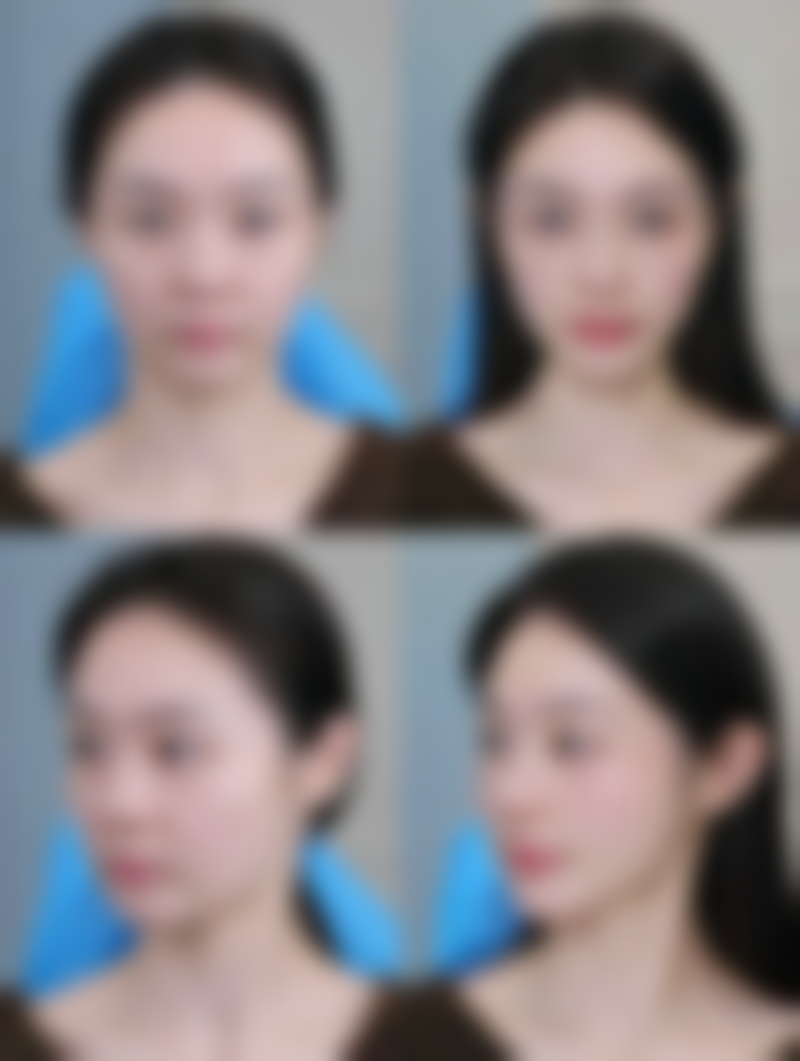 六、阴道前后壁修复手术所依赖的技术 / 材料，现实优势与限制并存