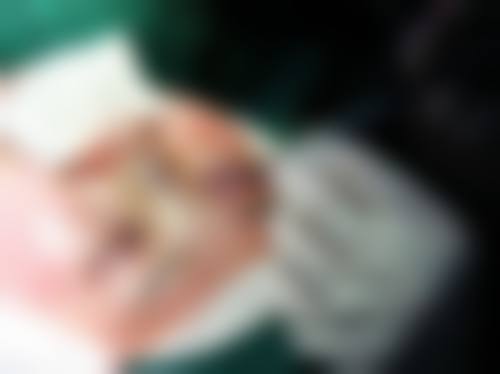 哪些使用场景下减肥使单眼皮变双眼皮的成效往往不理想