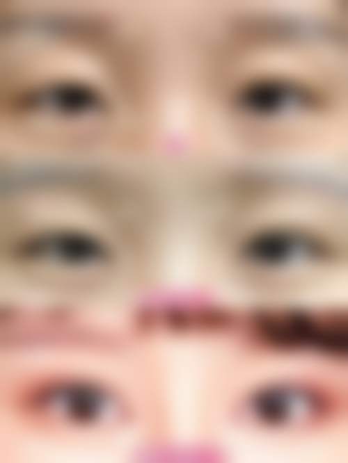 疤痕增生修复选择医院和医生的要点