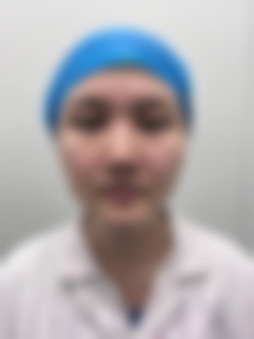 隆鼻后需要怎么护理：让美丽更持久