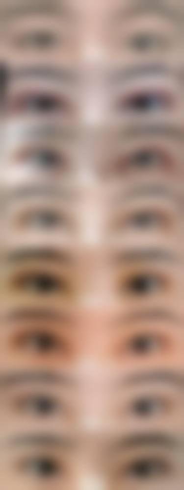 双眼皮开眼角的成效稳定性与哪些条件直接相关