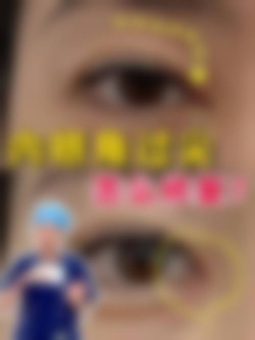 纳米无痕双眼皮哪些人群适合,哪些情况不建议选择?