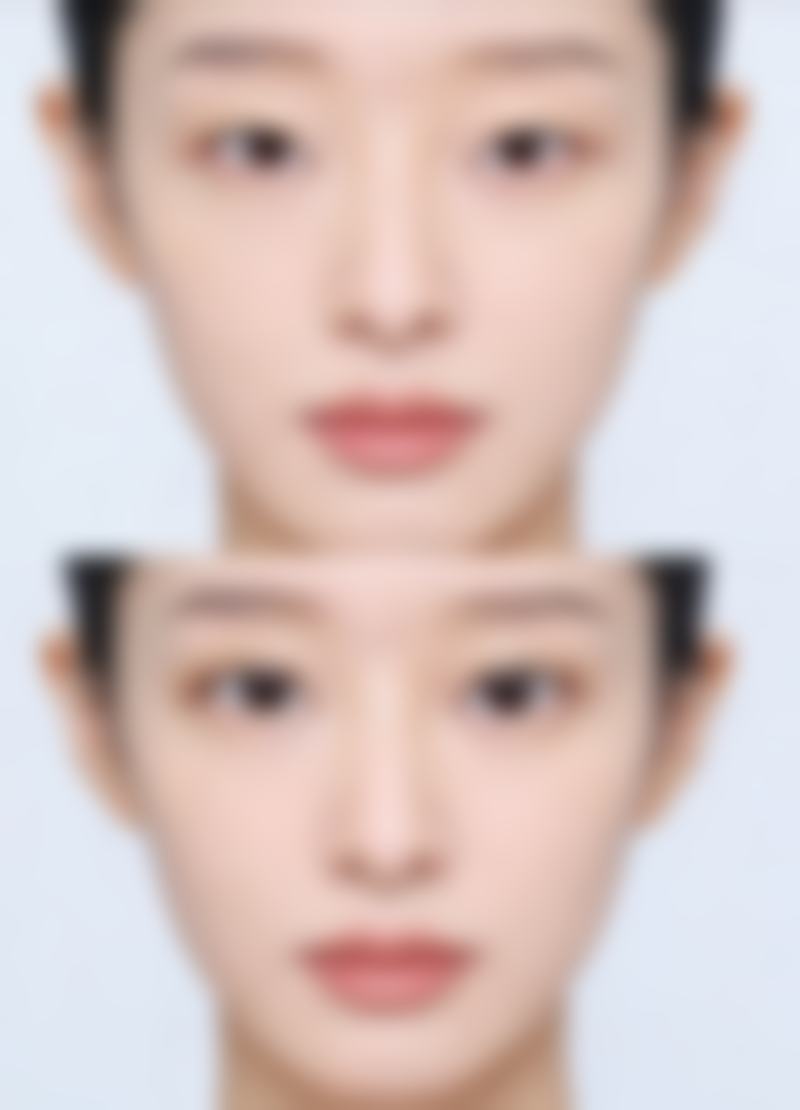 哪些部位或情况使用经期除皱时成效相对更稳定