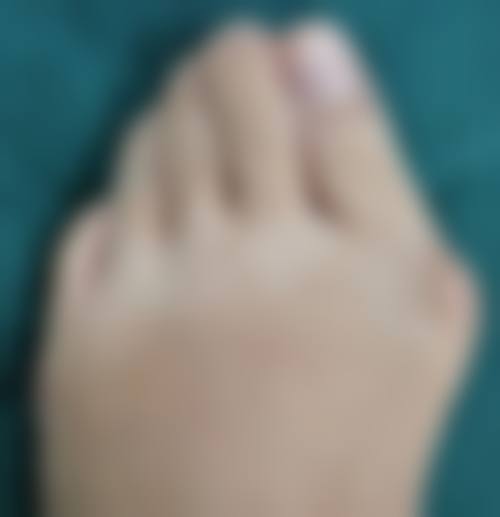 疤痕妊娠要住院多久？时间因人而异！