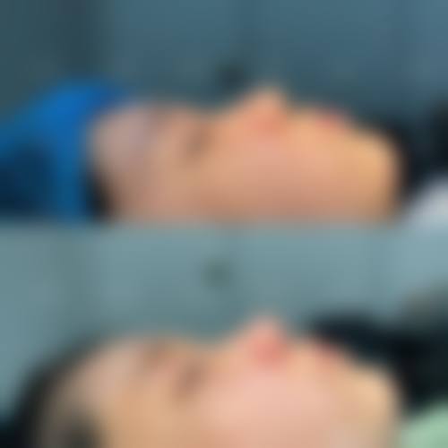 韩式隆鼻是否有危险的判断依据