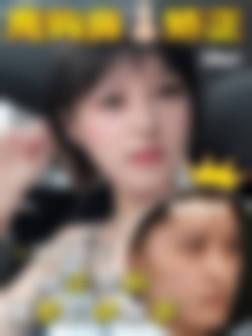 异体肋骨隆鼻做决定前，普通用户更容易忽略的问题