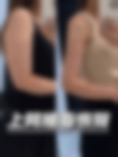 手术抽脂能瘦多少斤？