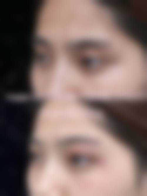 {艾灸眼部能消眼袋吗？能！2026中医灸法促循环代谢，轻松告别眼袋困扰