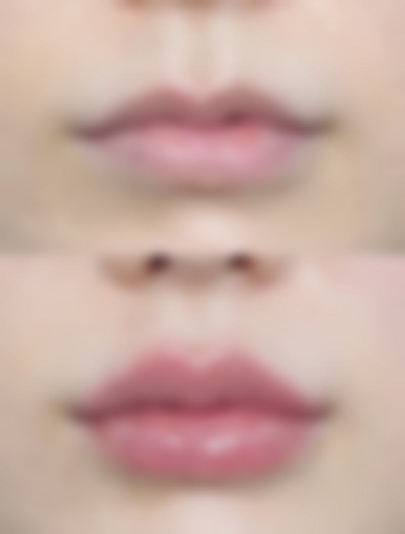 八、没睡好怎么消除眼袋？冰敷按摩加眼膜的成效稳定性取决于哪些因素？