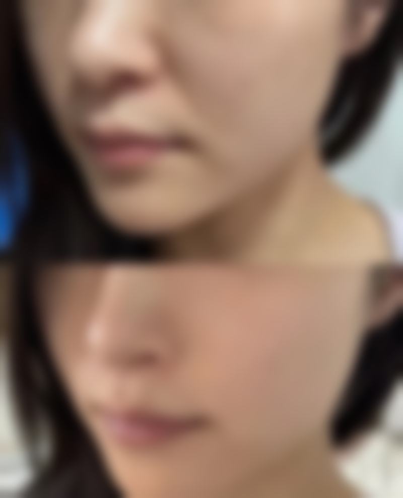 三、从医学角度看，没睡好怎么消除眼袋？冰敷按摩加眼膜的核心目的是什么？