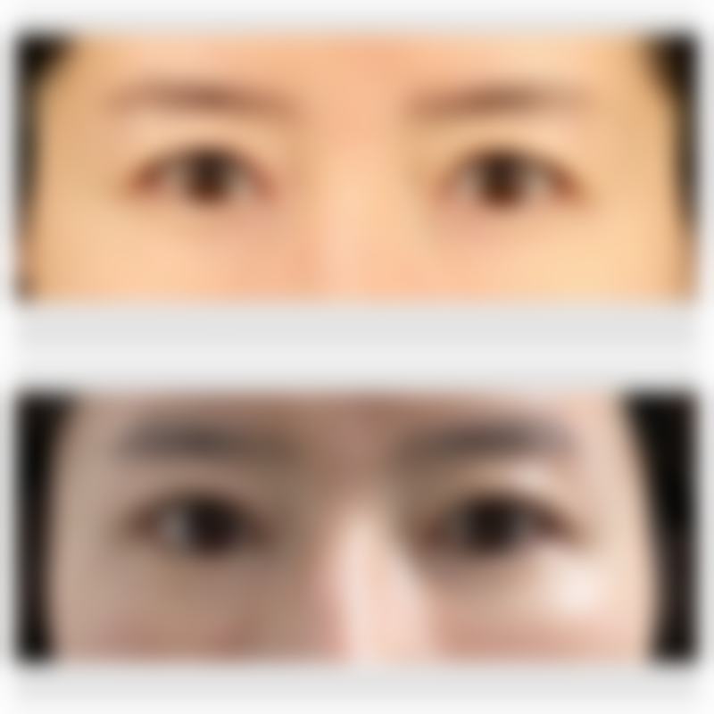 疤痕妊娠住院治疗费用，多少得看情况！