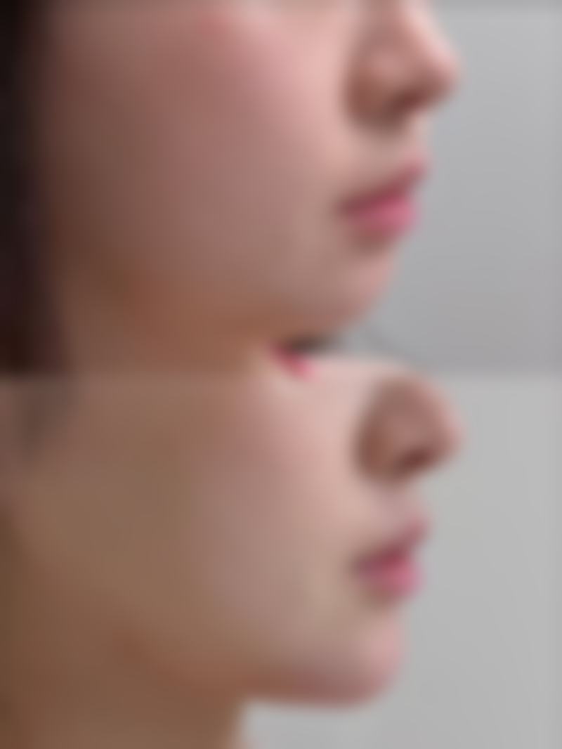 四、影响没睡好怎么消除眼袋？冰敷按摩加眼膜安心性的关键变量有哪些？