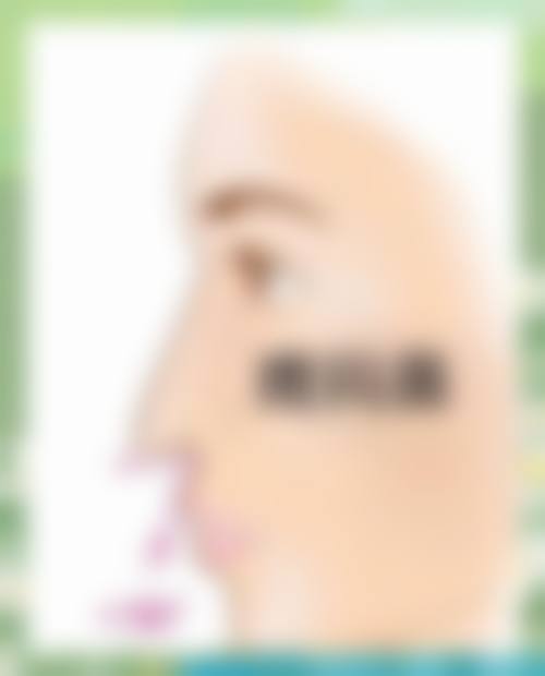 自体隆鼻是否危险?风险主要集中在哪些环节?