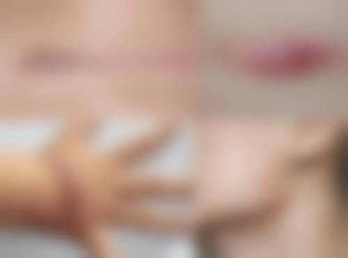 涂抹药物真的能让增生疤痕发红修复正常颜色吗?