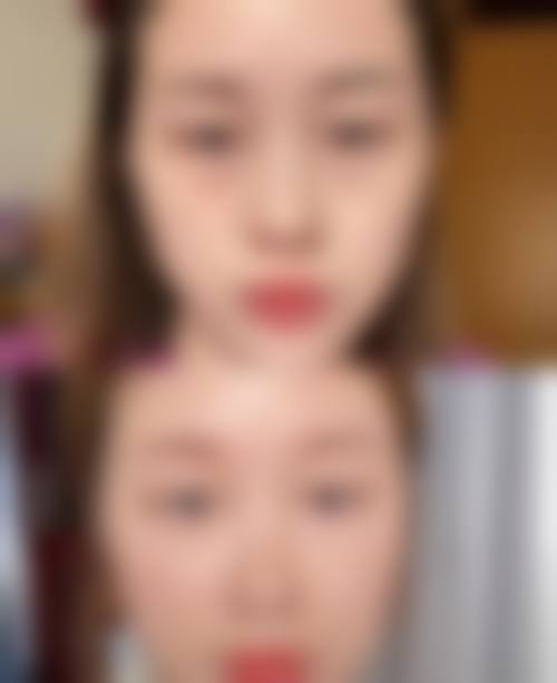 哪些情况通常不被认为是合适指征？