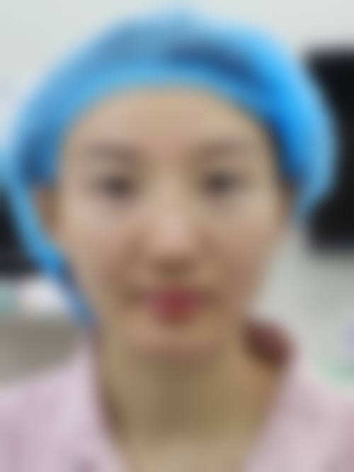 维生素E按摩消除熬夜眼袋的成效分析