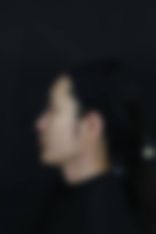 冷静总结：什么情况下，自体软骨隆鼻适合进入下一步评估