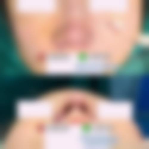 自体隆鼻医院与医生选择中,哪些因素更关键?及医院医生推荐!