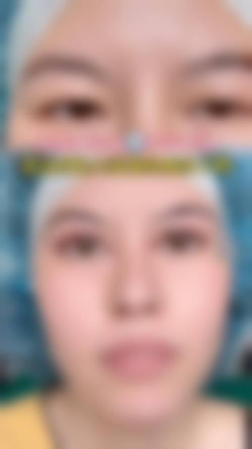 白醋加牙膏去眼袋的原理分析