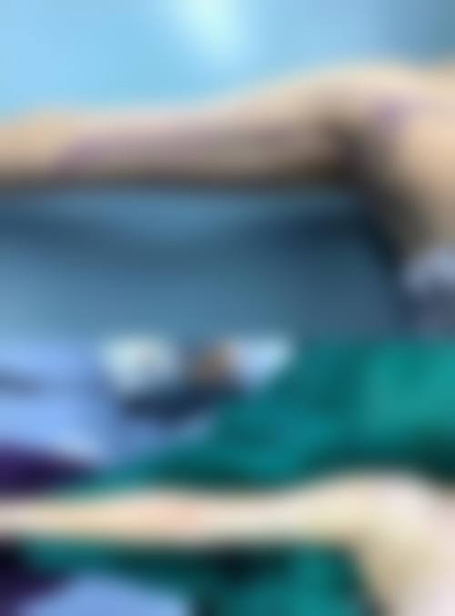 北京、上海优质医院：全身抽脂修复后怎样保持不反弹？