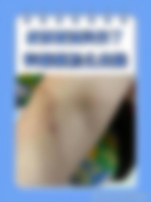 {有什么能修复疤痕？硅酮凝胶+激光+微晶磨皮术效果实测，费用多少？值得一试！