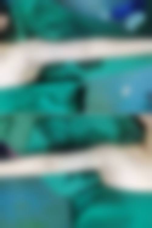 从医学角度看,全身吸脂减肥的风险主要集中在哪些环节?