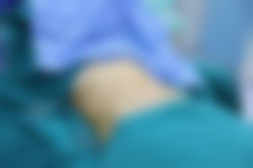 全身吸脂减肥本身能解决什么、不能解决什么?