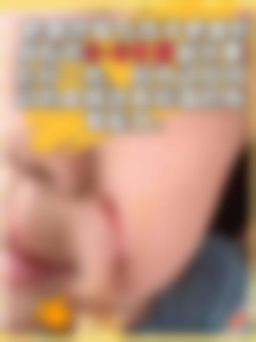 额头疤痕面相化解之法