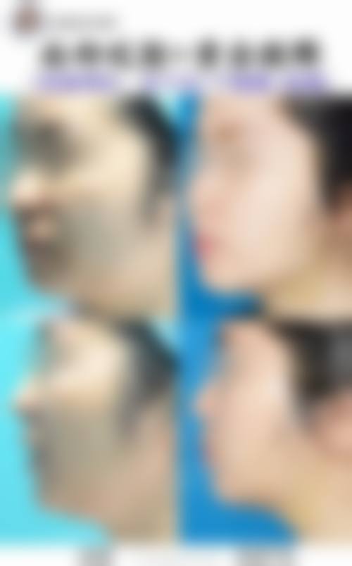 四、影响瘦脸针国产和进口安心性的关键变量有哪些？