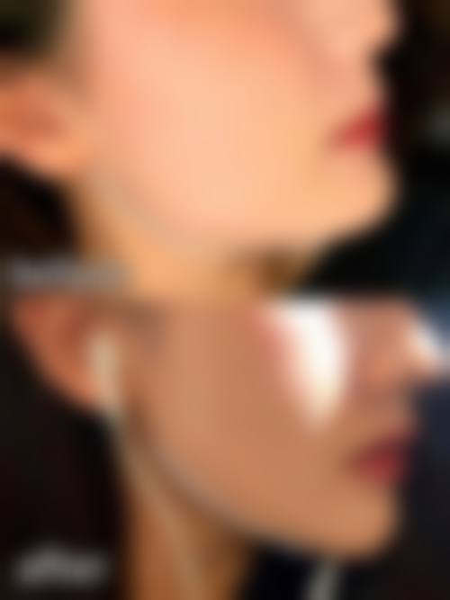 十一、在决定使用瘦脸针国产和进口的前，普通用户更容易忽略的关键信息