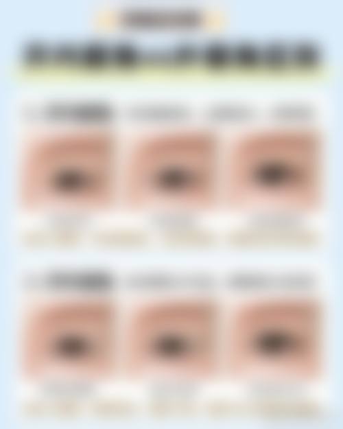 双眼皮手术的收费价格是多少，如何预约挂号？