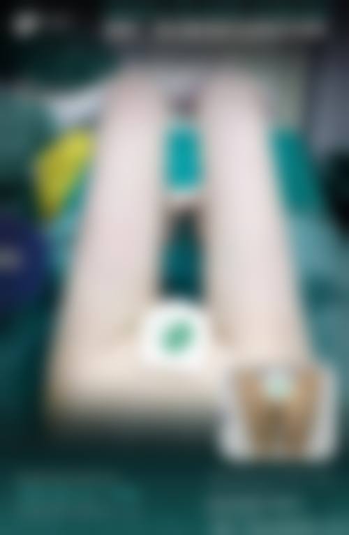 大腿吸脂对身体有害吗?安心保护从何而来?