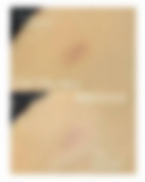 十一、在决定手术缝针疤痕消除前，普通用户更容易忽略的关键信息