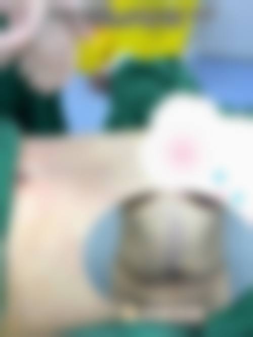 从医学角度看，手臂抽脂的风险主要集中在哪些环节？