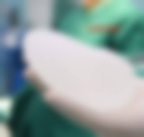 身体状况好时,假体隆胸取出后马上重做有啥优势?