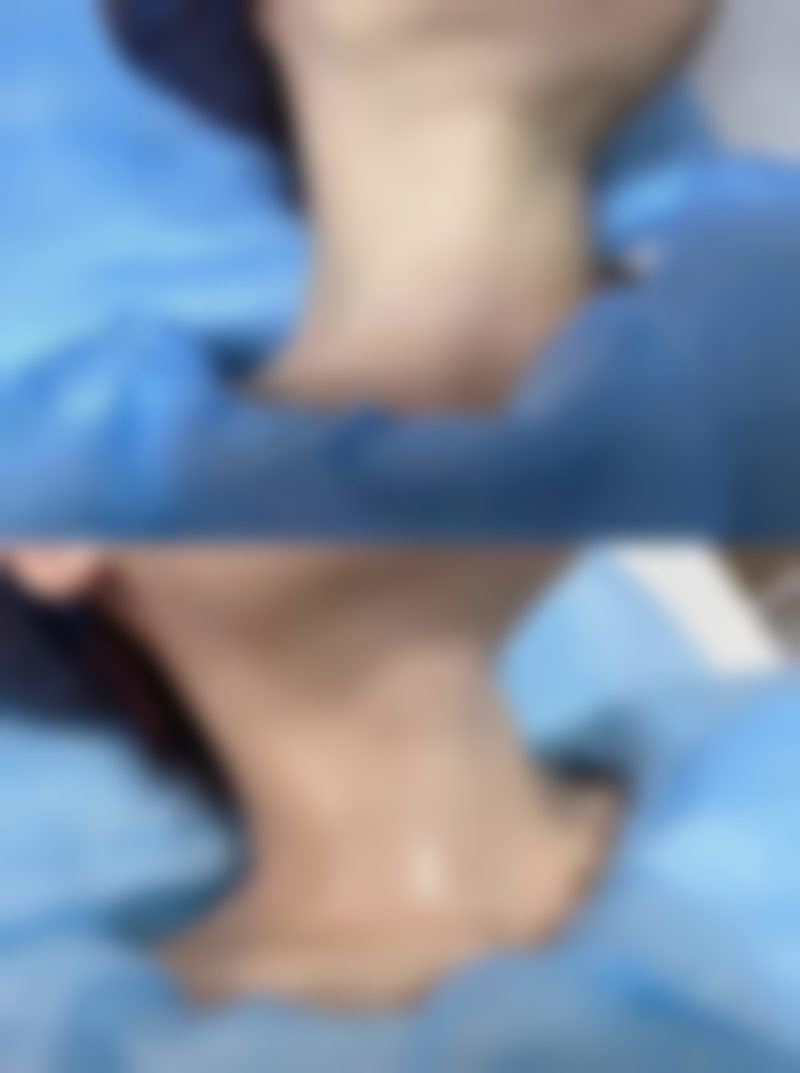 十一、在决定阴道紧缩术前,普通用户更容易忽略的关键信息