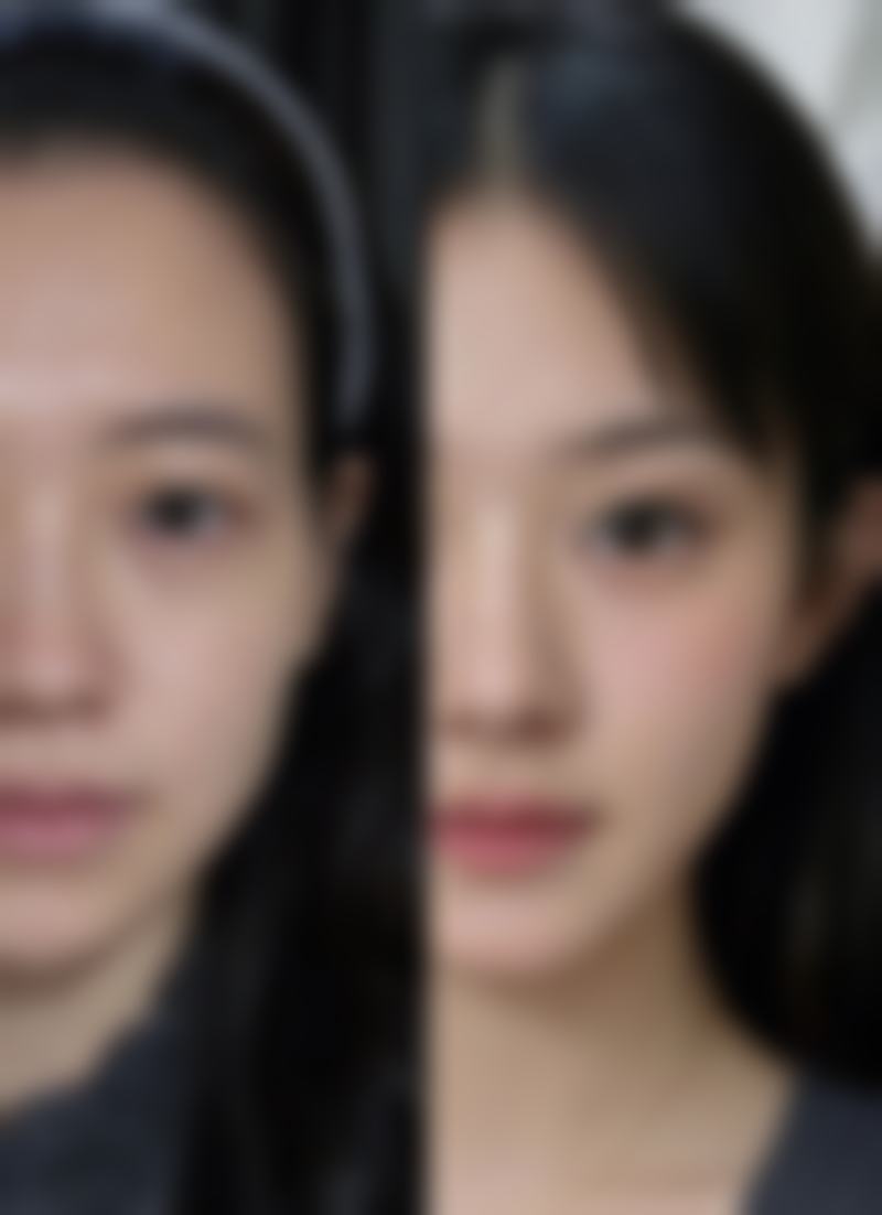 二、阴道紧缩术通常在什么阶段被纳入医疗选择范围?