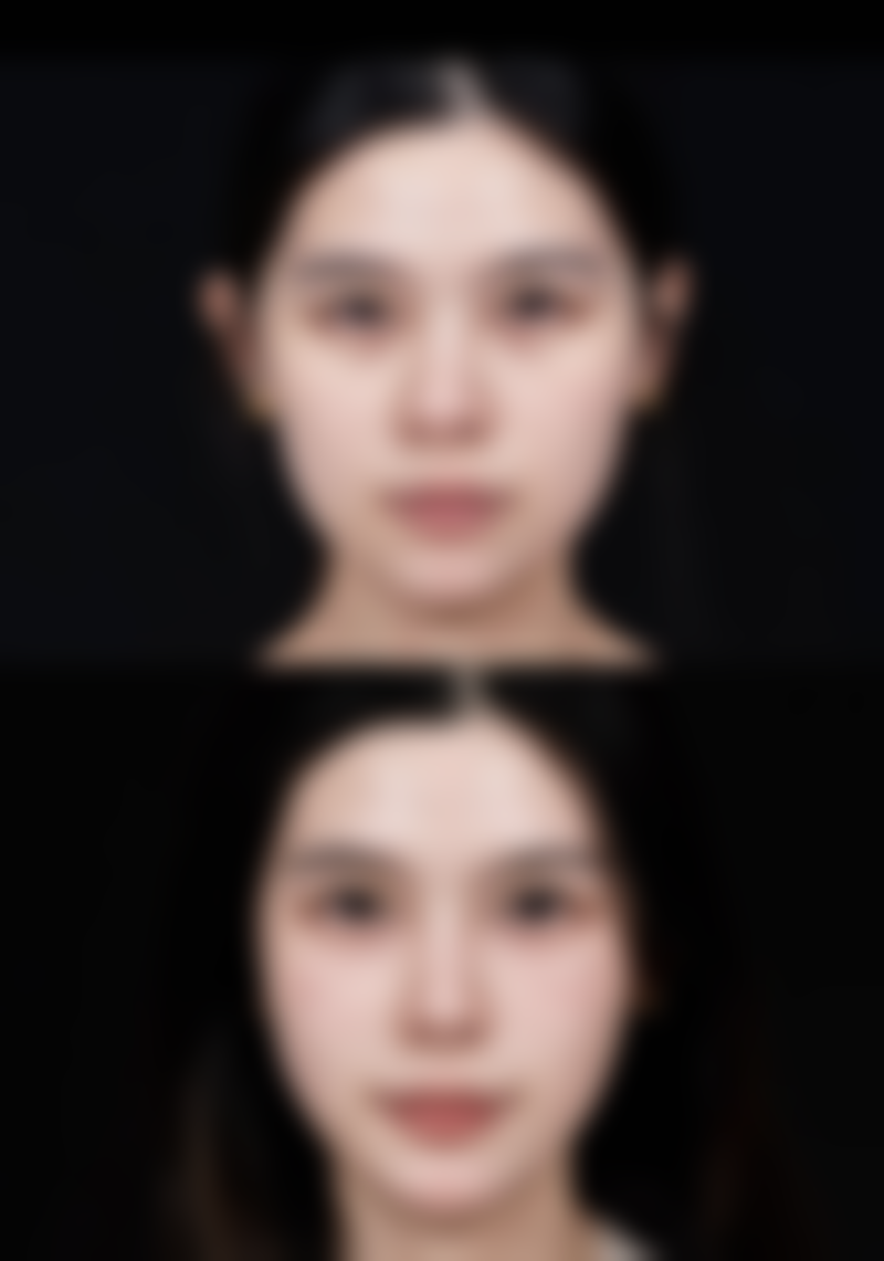 三、从医学角度看,阴道紧缩术的核心目的是什么?